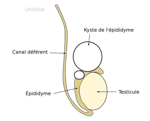 traitement naturel kyste testiculaire